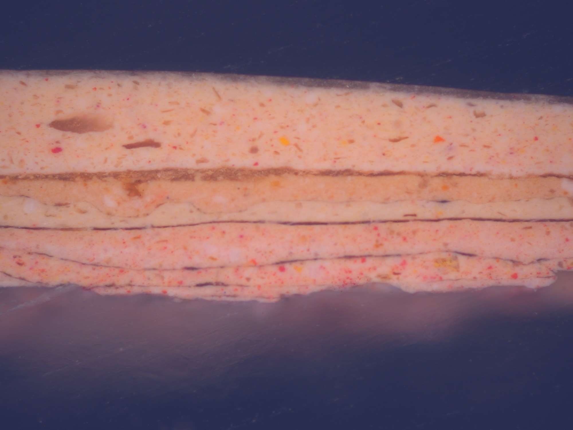 Stratigrafia dell'incarnato del volto